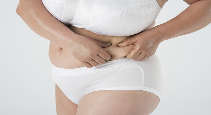 obesidad salud